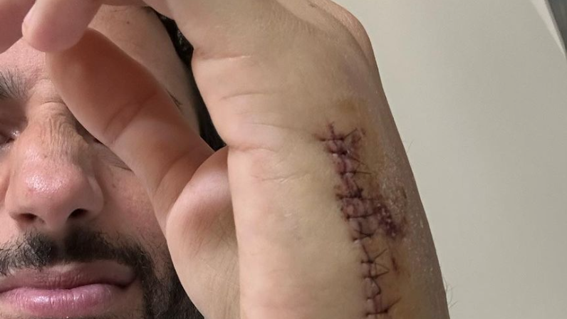 Daniel Ricciardo displays massive post-surgery wound